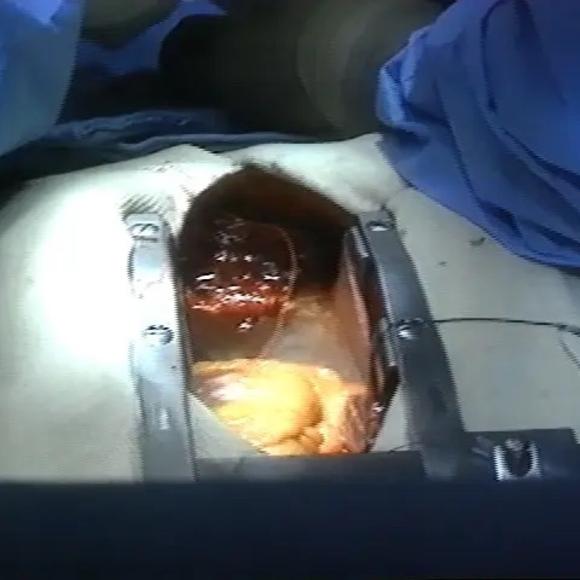 Production Frame Grab: Surgery